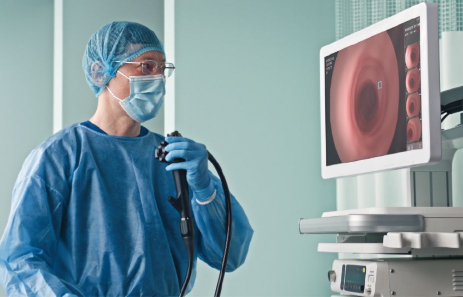 内視鏡イメージ写真